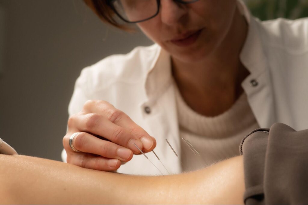 Woman putting acupuncture needles into a person’s back.